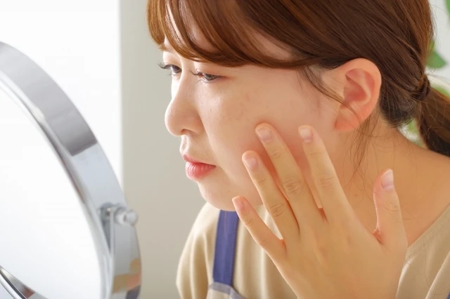 更年期のニキビ、吹き出物に悩んでいませんか？解決策がここにあります！